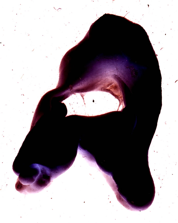 Portfolio / Projekt / Chewit before Chewit after / Typographie